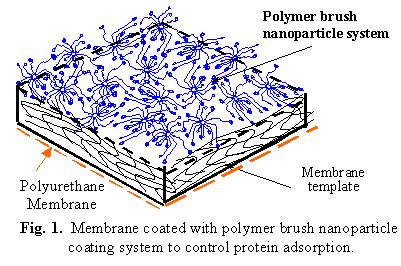 Membrane coated with polymer brush nanoparticle coating system to control protein adsorption